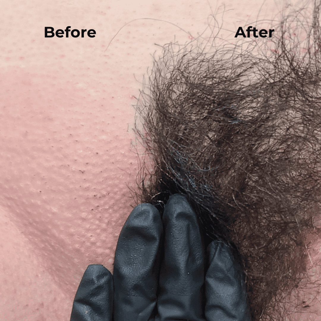 Pink Hypoallergenic Hard Wax Sample