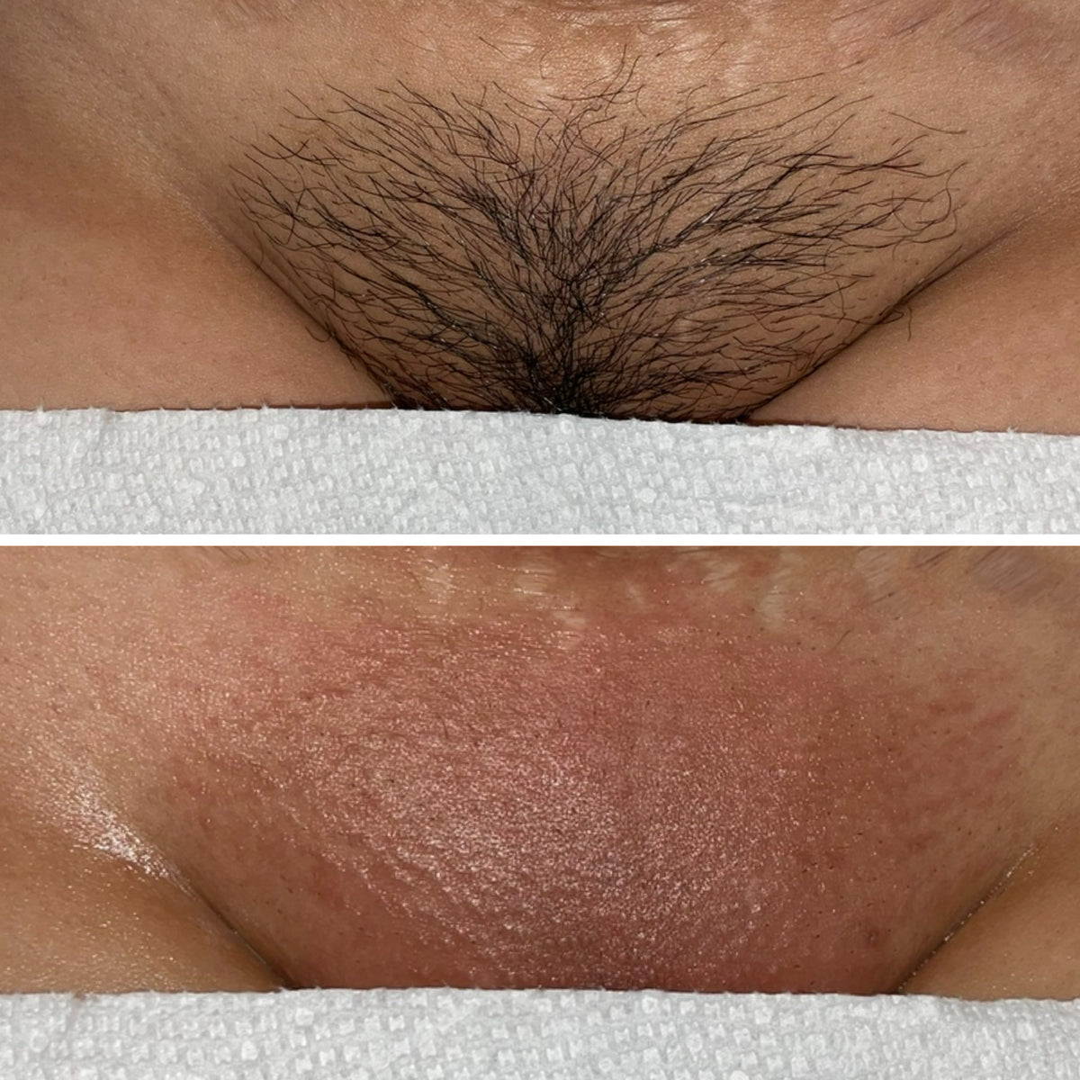 Peel-Off Jelly Mask
