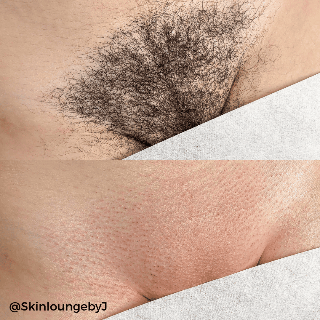 Brazilian Waxing Hard Wax Trio